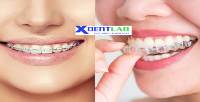 introduce Aligners Manufacturing Company