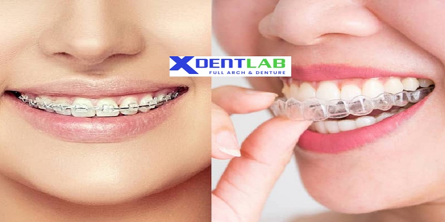 introduce Aligners Manufacturing Company