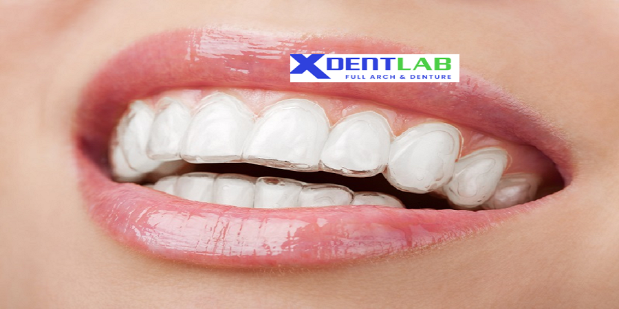 Clear aligner dental labs