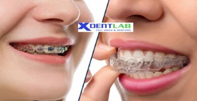 Global orthodontic outsourcing services