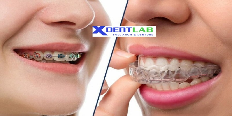 Global orthodontic outsourcing services