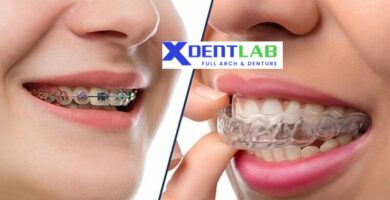 introduce International Clear Aligner Suppliers