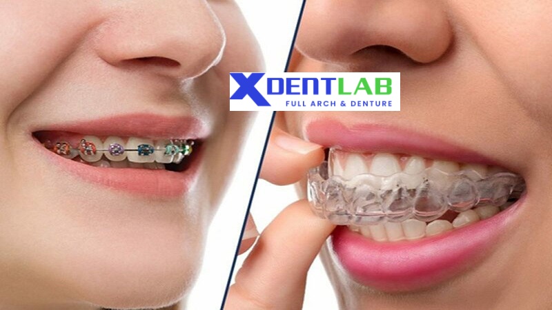 introduce International Clear Aligner Suppliers