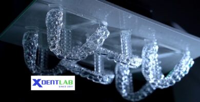 3D printed aligners