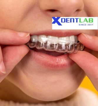 Introduce Overseas Clear Aligner Manufacturers