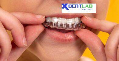 Introduce Overseas Clear Aligner Manufacturers