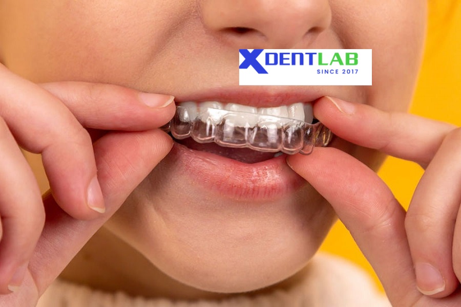 Introduce Overseas Clear Aligner Manufacturers