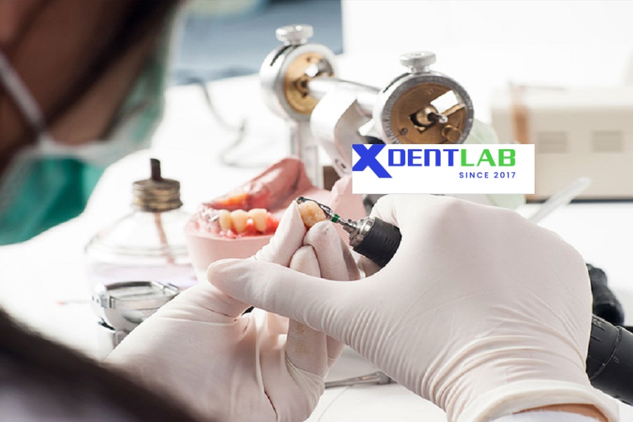 Vietnam's Dental Laboratories