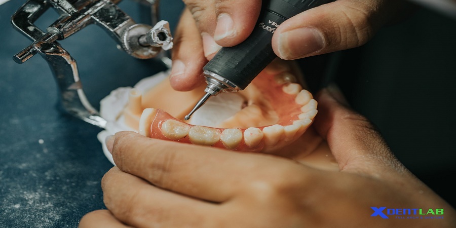 Vietnam Dental Labs District 9 Ho Chi Minh City