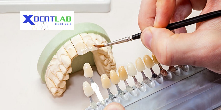 Vietnam dental laboratories district 8 Ho Chi Minh